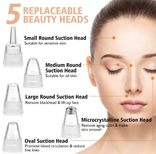 Novix™ Blackhead Remover